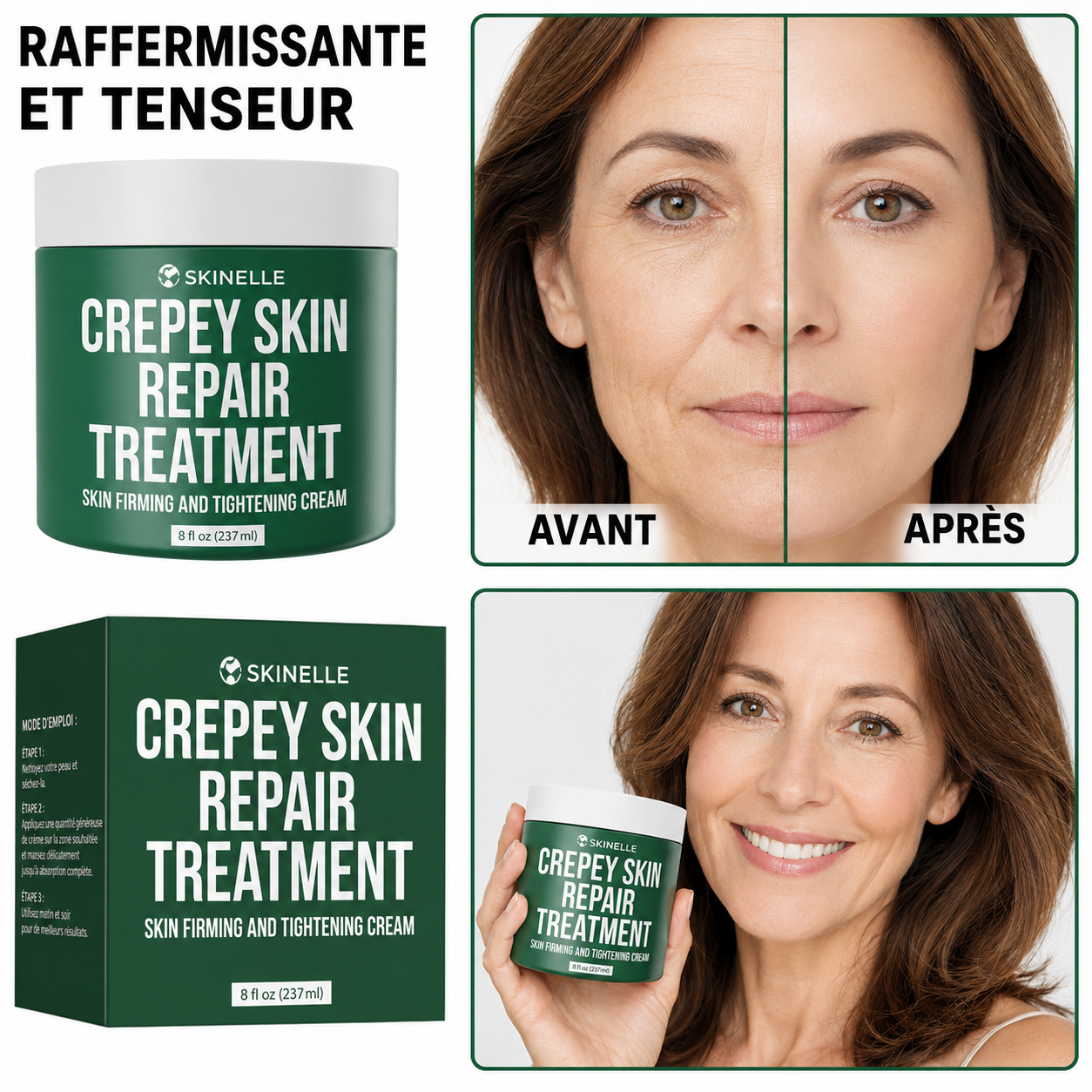 Crème Réparatrice Peau Fripée Skinelle