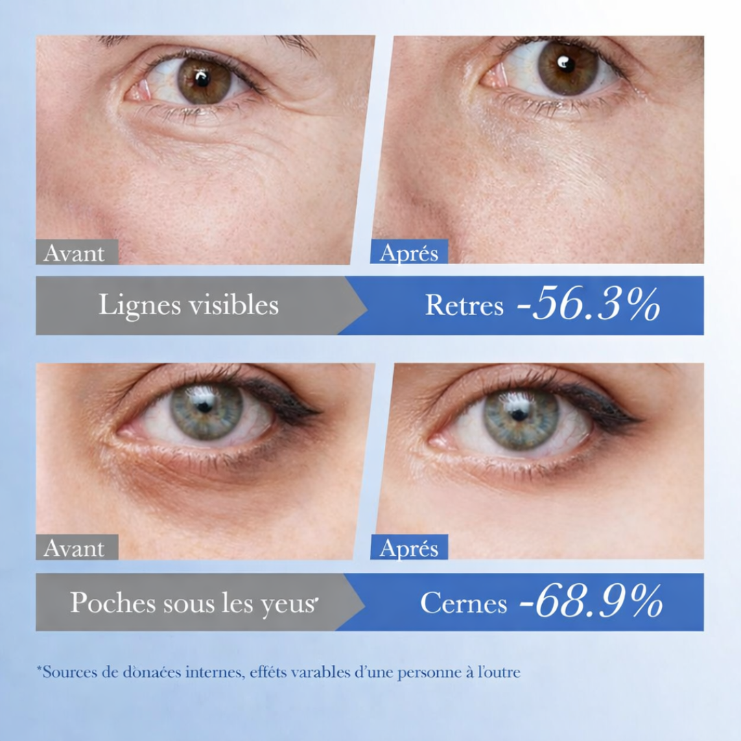 Crème Contour des Yeux Skinelle Caviar + Acide Hyaluronique – Anti-Âge & Réduction des Cernes (20g)