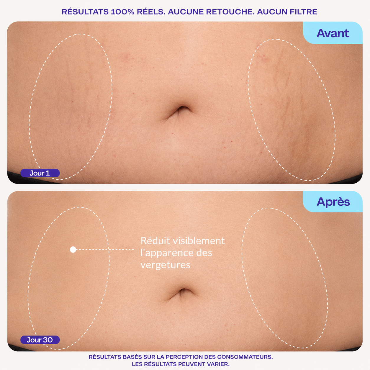 Skinelle Crème Raffermissante Anti-Âge pour le Ventre