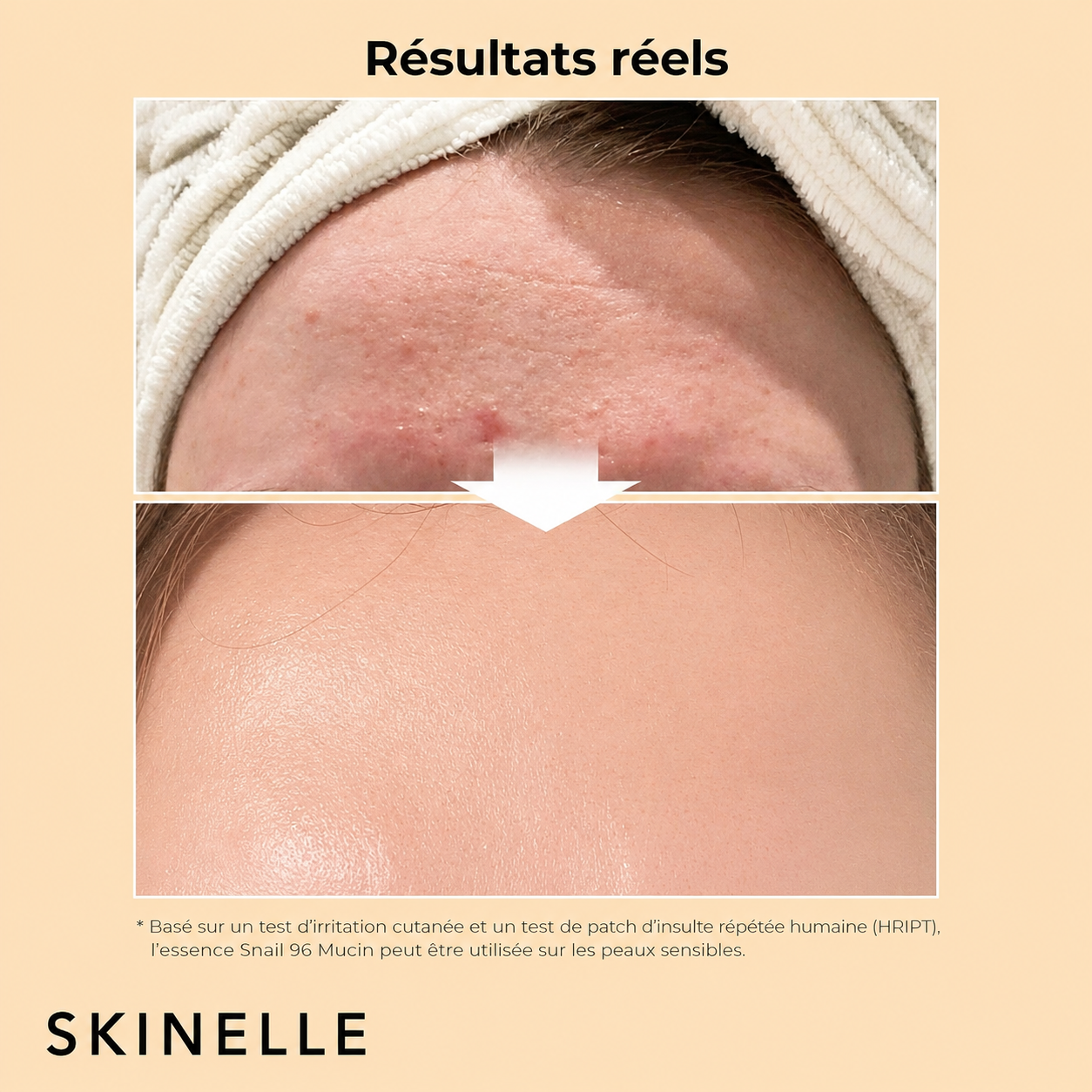 Retrouvez une peau plus jeune avec la Crème Advanced Snail 92