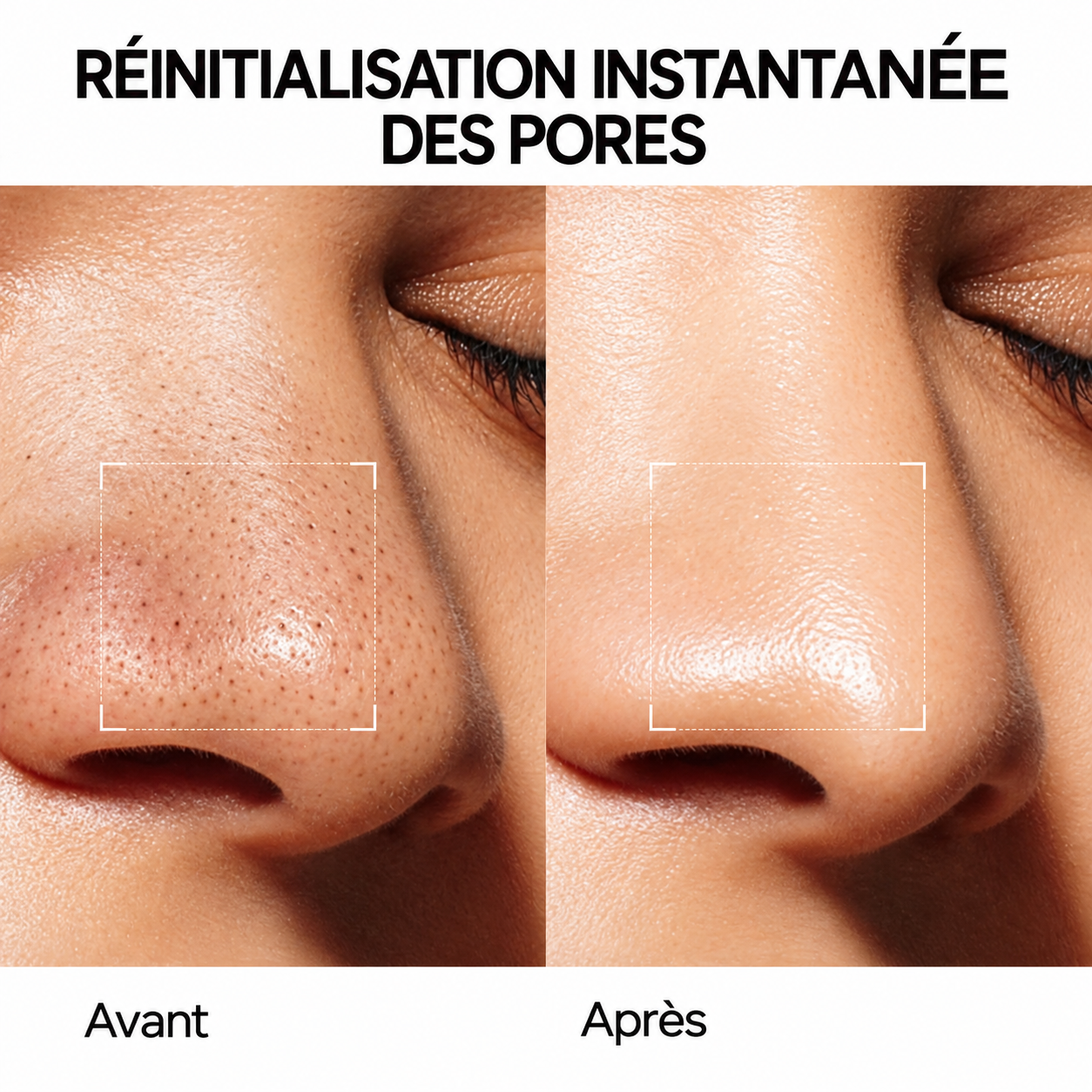 SKINELLE Stick d’Argile Purifiant pour les Pores