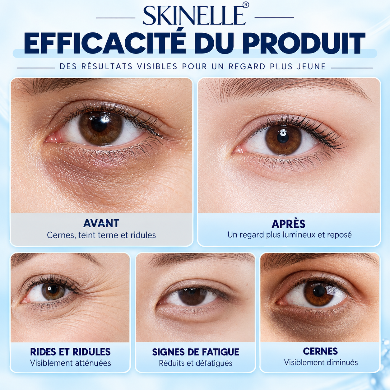 SKINELLE® Sérum Contour des Yeux Raffermissant à Effet Liftant