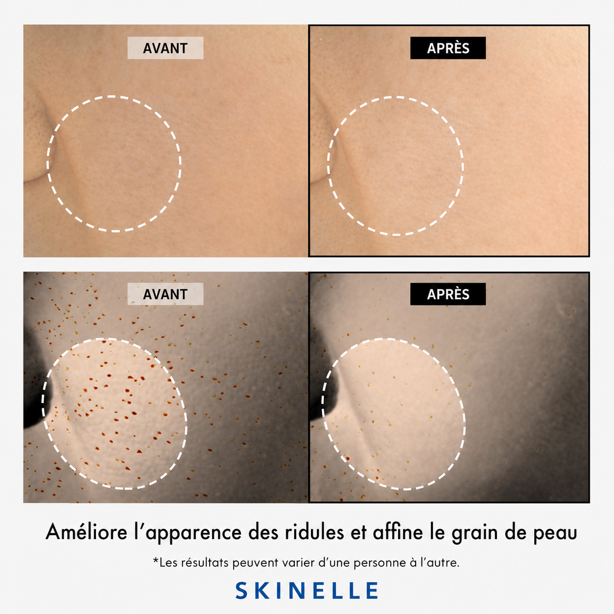 SKINELLE Crème Peptide de Cuivre 12